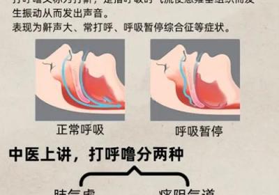 打呼噜是什么原因引起的原创