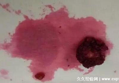 杨梅汁弄到衣服上怎么处理，直接用牙膏(白醋时间长也能清洗)