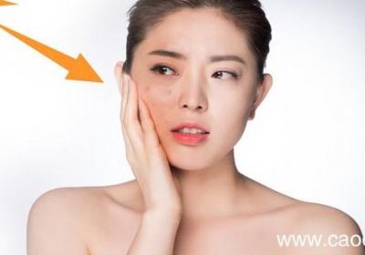 冬天应该如何防晒 冬天需要防晒吗