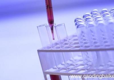 铝单质与氢氧化钠溶液反应的方程式 铝单质与氢氧化钠溶液反应的方程式是什么