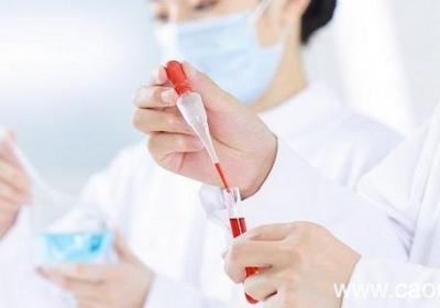 硝酸银溶液与稀盐酸反应的化学方程式 硝酸银溶液与稀盐酸反应方程式