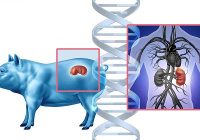 科学家弄清人体如何排斥猪器官