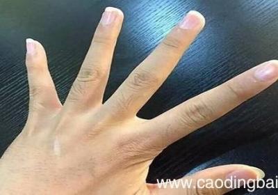 手指关节疼痛的原因