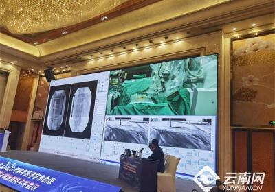 开启智慧医疗新篇 云南首例远程骨科手术机器人手术完成