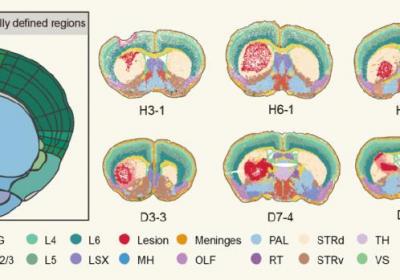 科学家成功绘制鼠脑出血后时空分子图谱