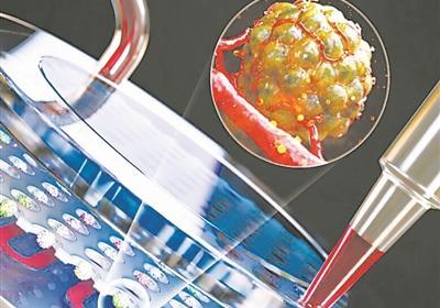 微流芯片实时分析癌细胞与血管间作用