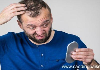梦见自己秃头了一块是什么意思 梦见自己秃头了一块有什么预兆