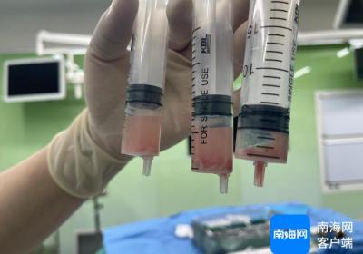 京琼专家联袂 多学科合作 海口市妇幼保健院首次实施超声引导下肝脓肿穿刺引流术