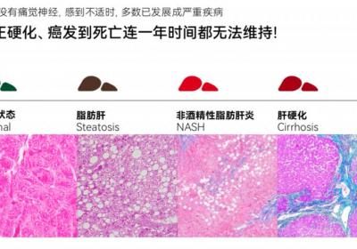 LAIFE“乐轻肝”：日常护肝新选择，守护您的健康生活