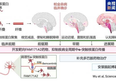 全球首次！复旦科研团队发现帕金森病全新治疗靶点