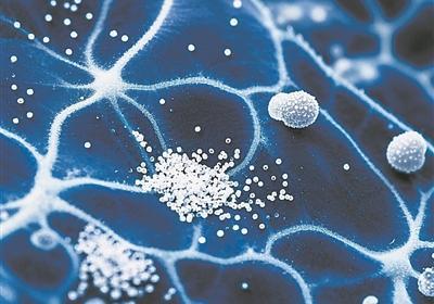 美国科研人员发现：大脑中微塑料浓度高于其他器官