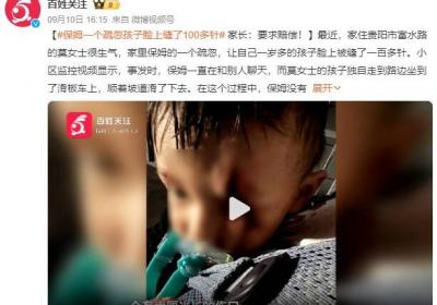 保姆一个疏忽孩子脸上缝了100多针：只顾着和别人聊天