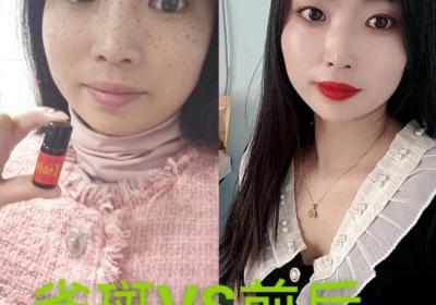 【孤芳自赏】祖传秘方祛痣点痣药水怎么代理，一次需要拿多少货